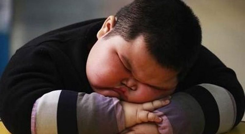 چاقی مفرط در کودکان و راه های پیشگیری و درمان