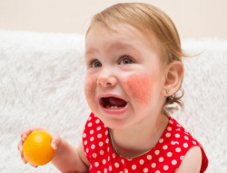 آلرژی غذایی کودکان چیست و چه نشانه هایی دارد؟ – بخش دوم