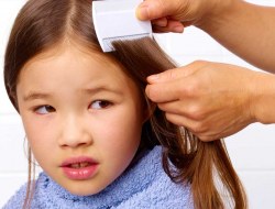 شپش سر کودکان چه نشانه هایی دارد و چگونه می توان آن را از بین برد؟