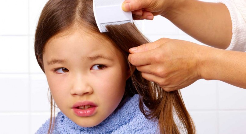 شپش سر کودکان چه نشانه هایی دارد و چگونه می توان آن را از بین برد؟